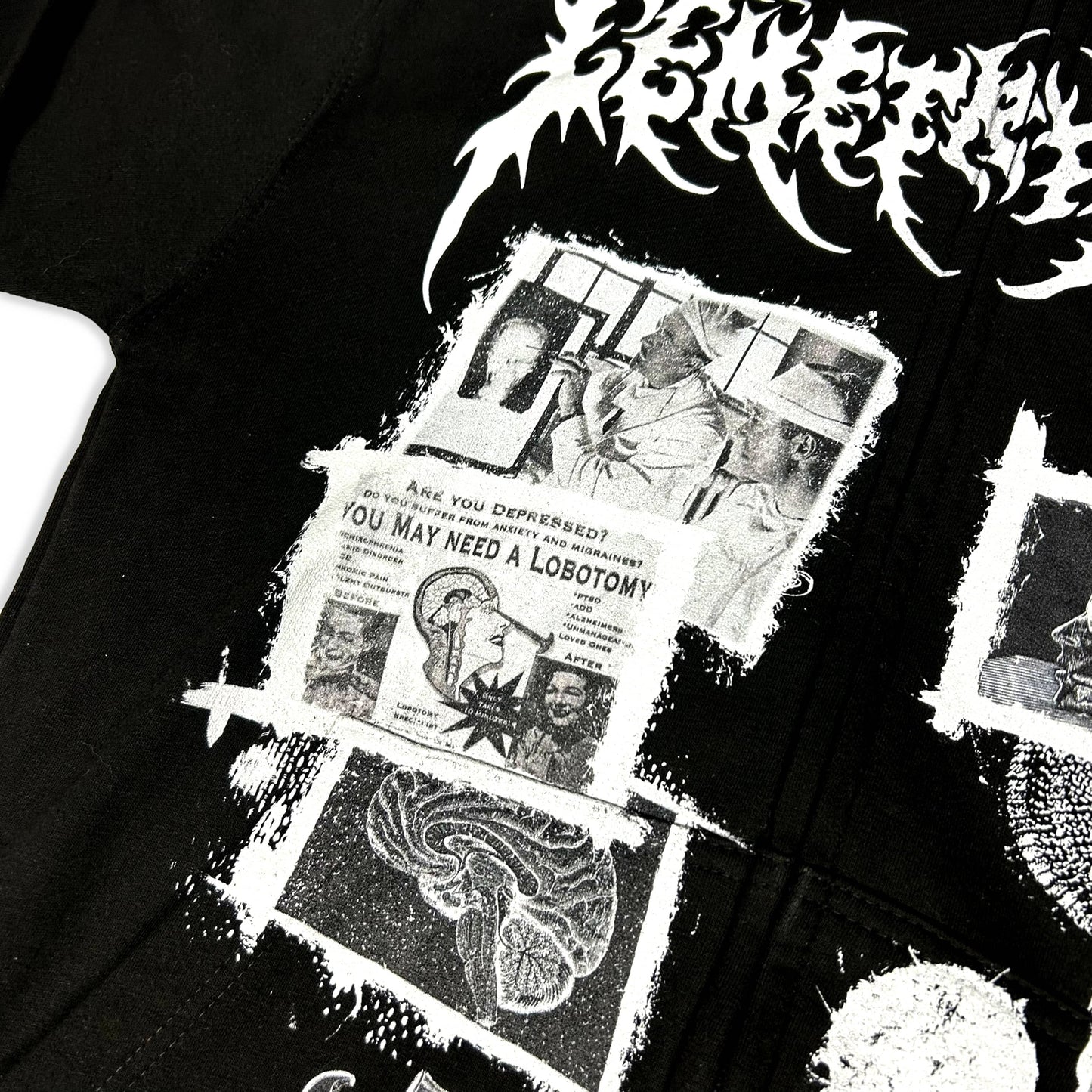 Lobotomy Cortex Zipper Hoodie - CemeteryCrypt