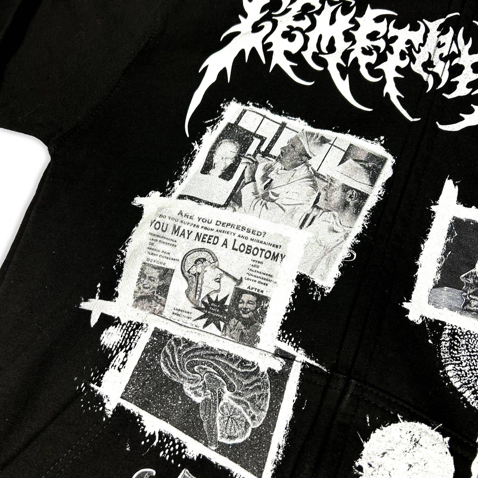 Lobotomy Cortex Zipper Hoodie - CemeteryCrypt