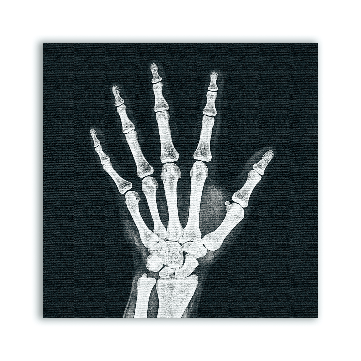 X - ray Hand Patch - CemeteryCrypt