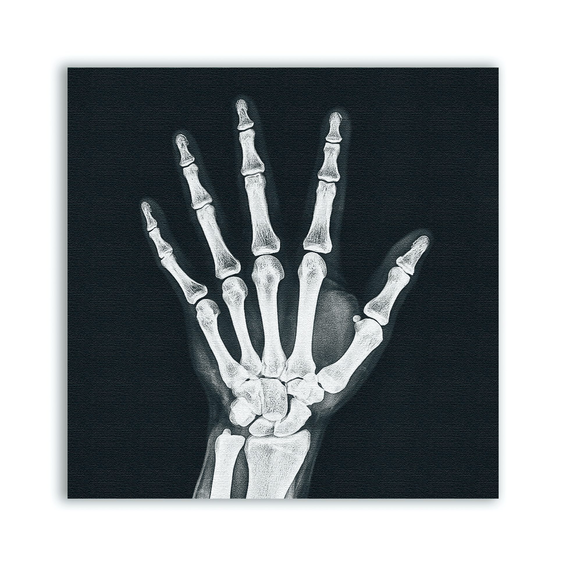 X - ray Hand Patch - CemeteryCrypt