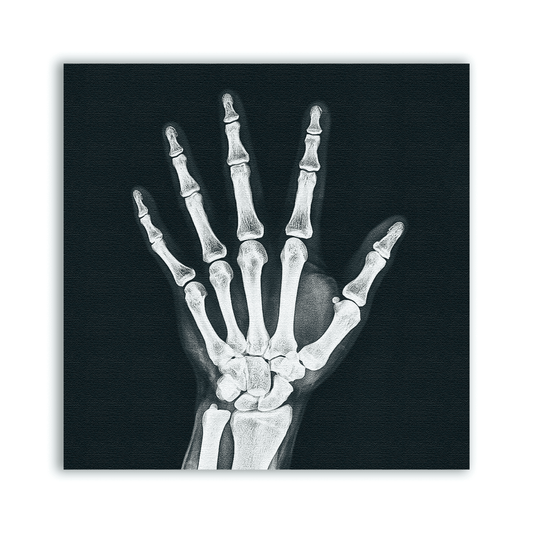 X - ray Hand Patch - CemeteryCrypt
