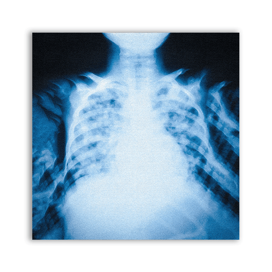 X - ray Rib Cage Patch - CemeteryCrypt