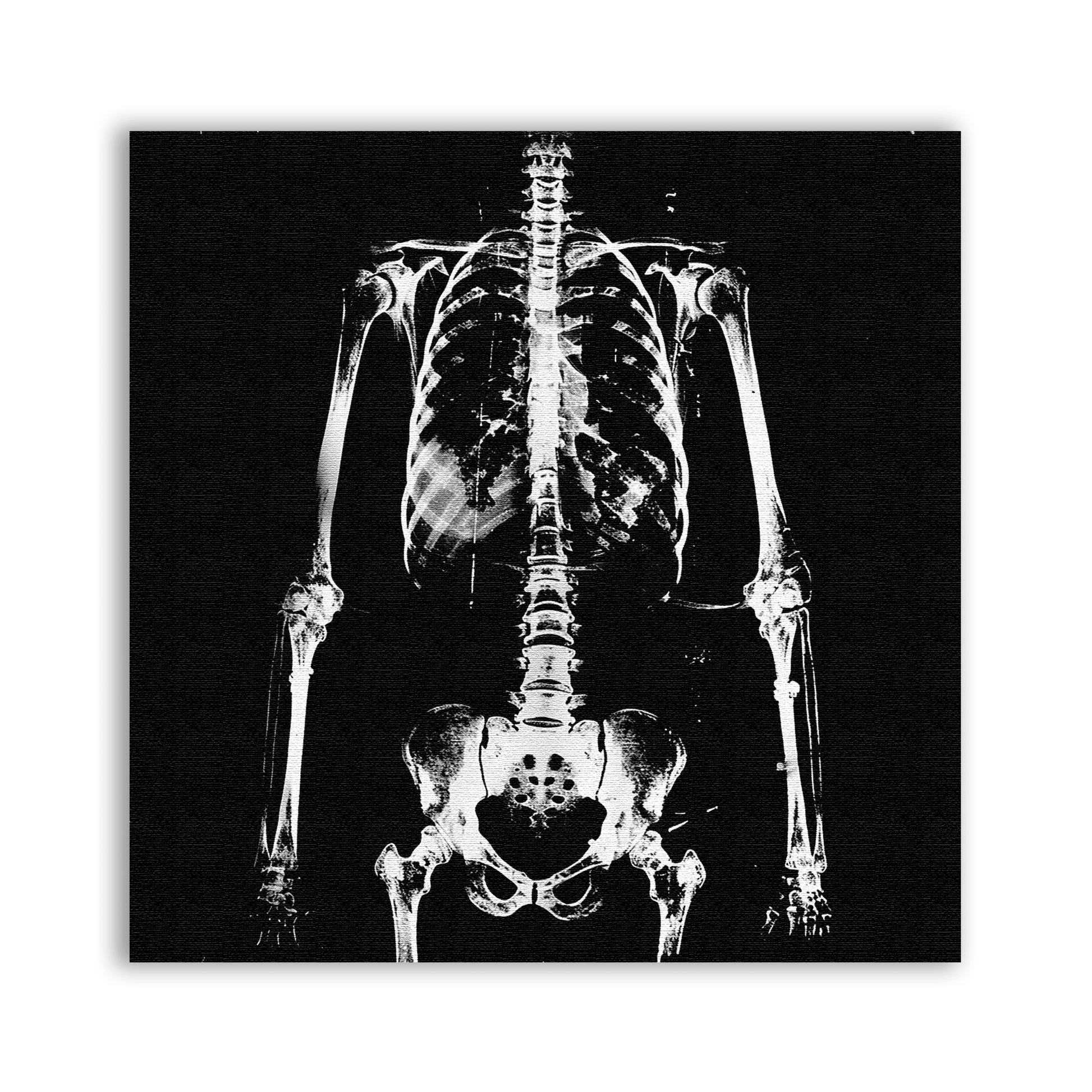 Xray Body Patch - CemeteryCrypt